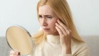 Melhores Soluções Naturais para Prevenir e Reduzir Rugas