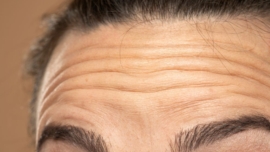 Melhores Tratamentos Faciais para Rejuvenescer Sem Cirurgia