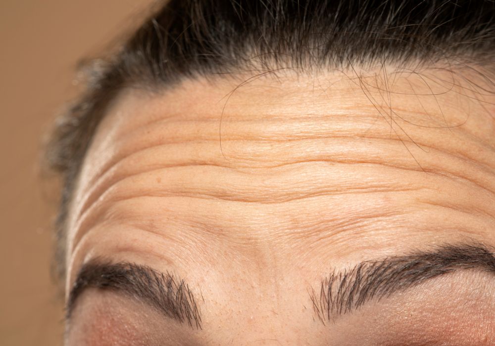 Melhores Tratamentos Faciais para Rejuvenescer Sem Cirurgia Melhores Tratamentos Faciais para Rejuvenescer Sem Cirurgia