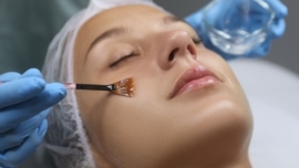 Peeling Químico para Rejuvenescer Quanto Custa, Indicações e Resultados