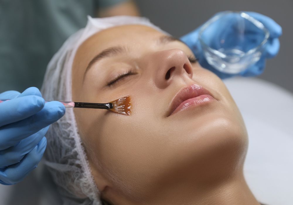 Peeling Químico para Rejuvenescer Quanto Custa, Indicações e Resultados Peeling Químico para Rejuvenescer Quanto Custa, Indicações e Resultados