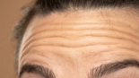 Melhor Retinol para Rugas Profundas O Segredo da Pele Renovada