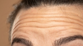 Melhor Retinol para Rugas Profundas O Segredo da Pele Renovada