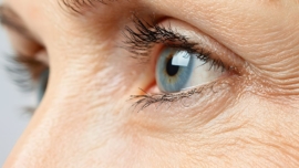 Melhor Tratamento Estético para Rugas ao Redor dos Olhos